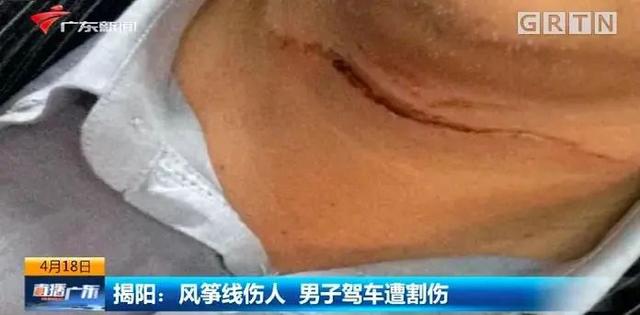 放风筝过程作文300字优秀（放风筝过程作文250字）